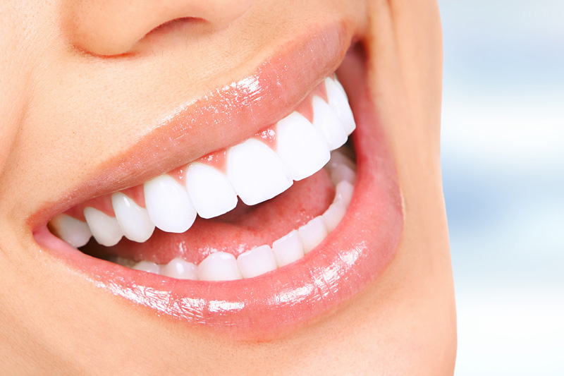 Cosmetic Dentistry in San Gabriel