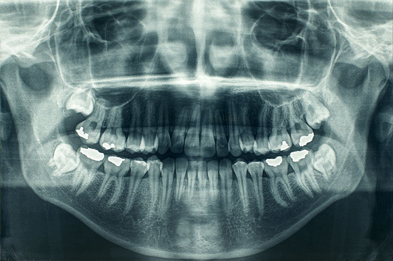 Cone Beam CT Imaging in 